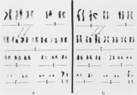 Chromosome