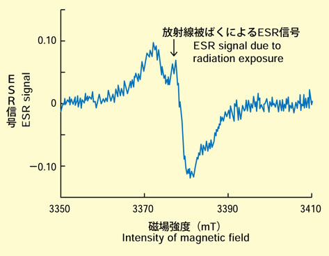 被爆者のESR信号