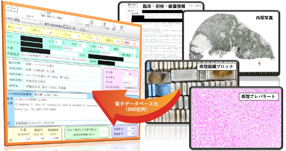 臨床情報・線量情報・病理学的情報を含むトロトラスト症資試料データベースを構築